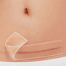 Load image into Gallery viewer, Silicone Scar Sheet 1.5″ x 15.5″
